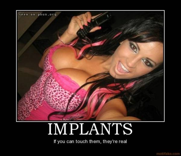 Implants.jpg